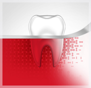 Bleeding Gums Tooth Gum Disease Stage 1 parodontax Bleeding Gums Tooth Gum Disease Stage 1 parodontax
