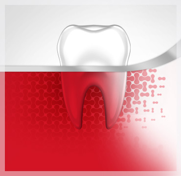 Bleeding Gums Tooth Gum Disease Stage 1 parodontax Bleeding Gums Tooth Gum Disease Stage 1 parodontax