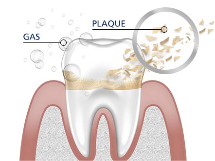 Teeth Cleaning parodontax Teeth Cleaning parodontax